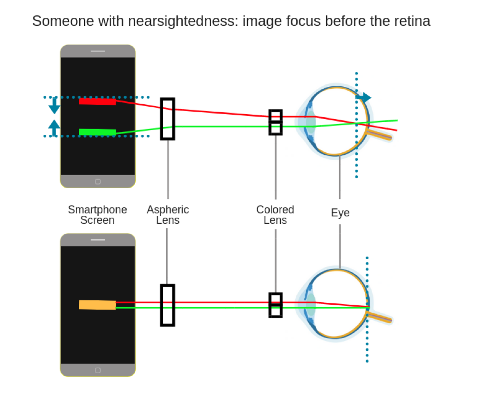 nearsightedness-diagram.png